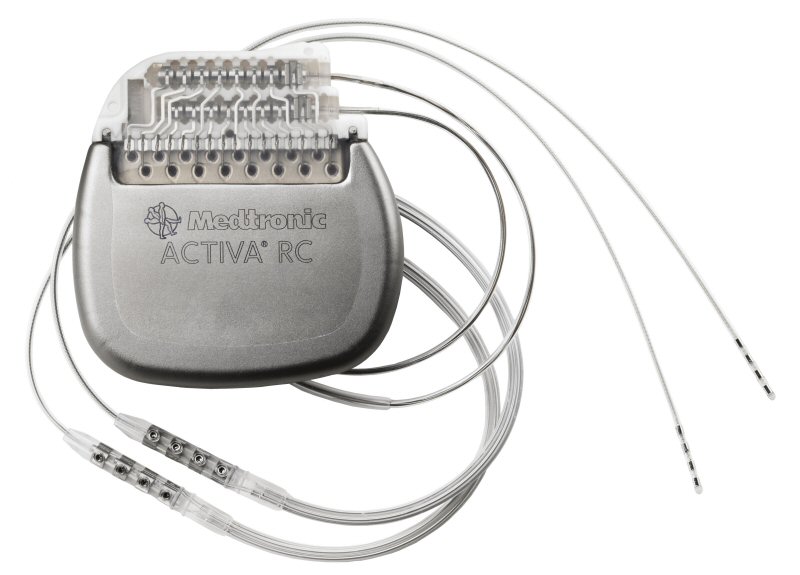 Deep Brain Stimulation